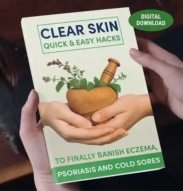 Bonus 1: Clear Skin — Quick and Easy Hacks to Banish Eczema, Psoriasis and Cold Sores